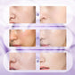 🎉2025 Neues Upgrade🎉 All-in-One Niacinamid-Creme